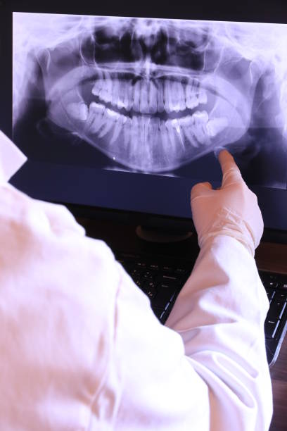 Best Emergency Wisdom Teeth Removal in Moodus, CT