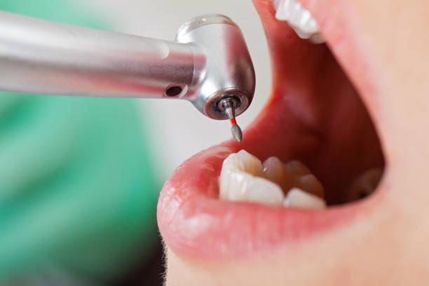 Best Emergency Denture Repair in Moodus, CT
